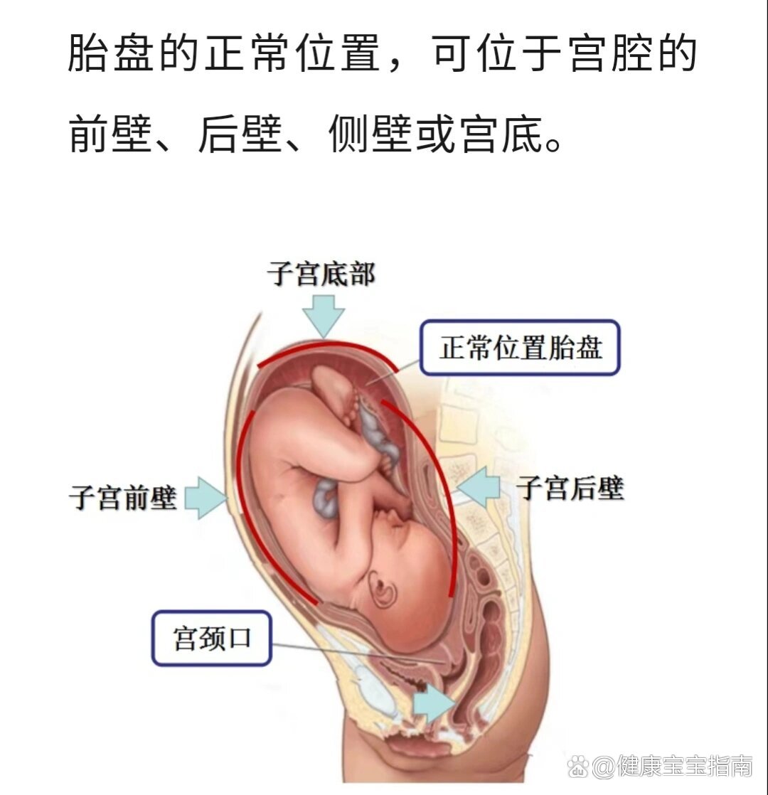 宫底位置图片图片