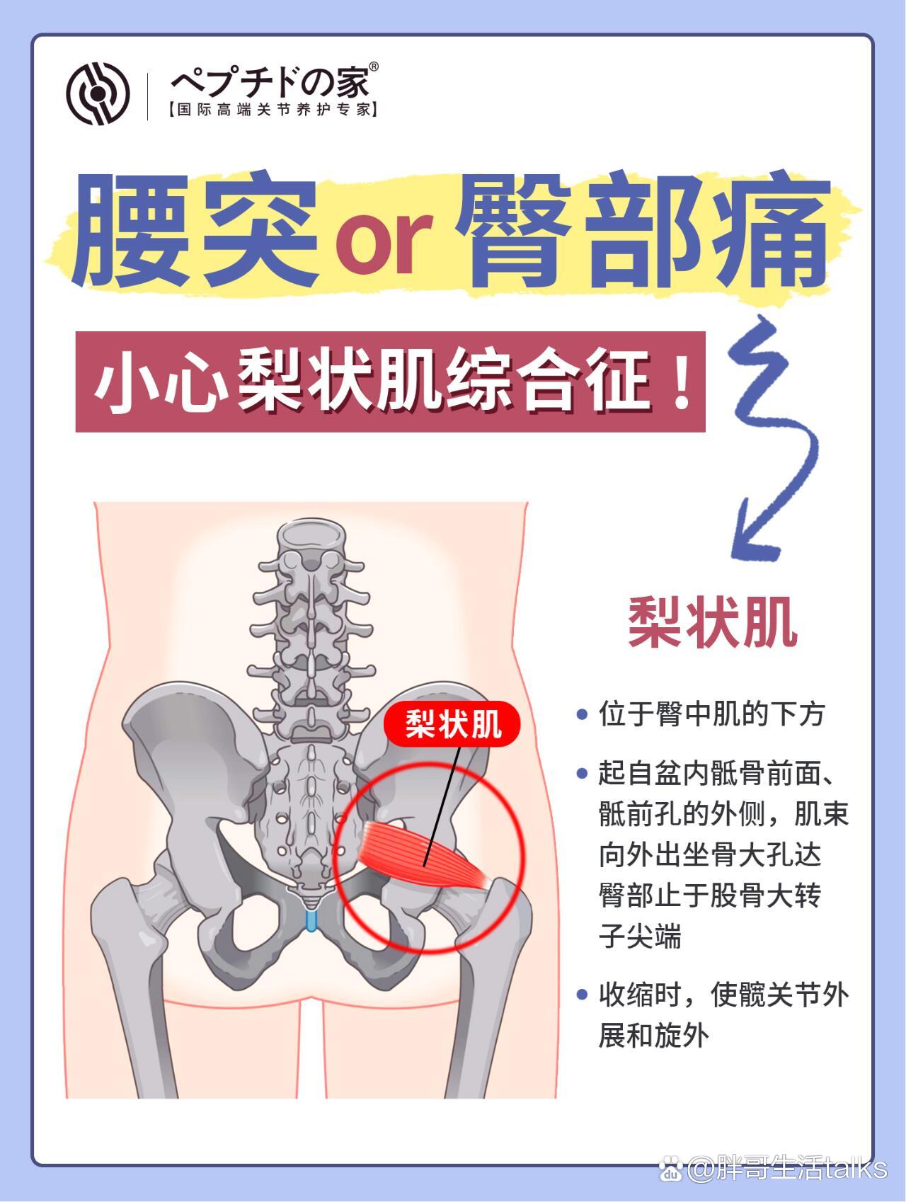 梨状肌体表定位图片