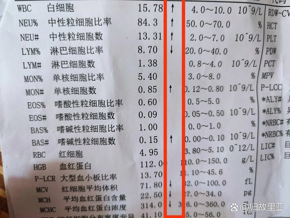 白血病怎么检查图片