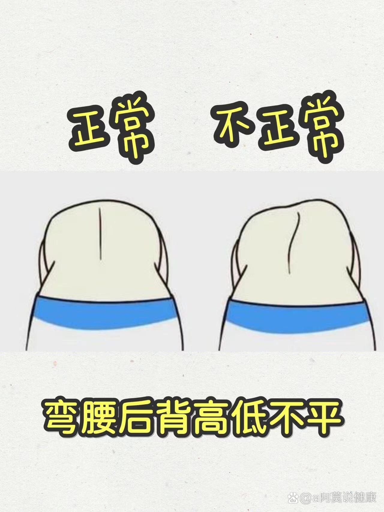 后背高低不平图片图片