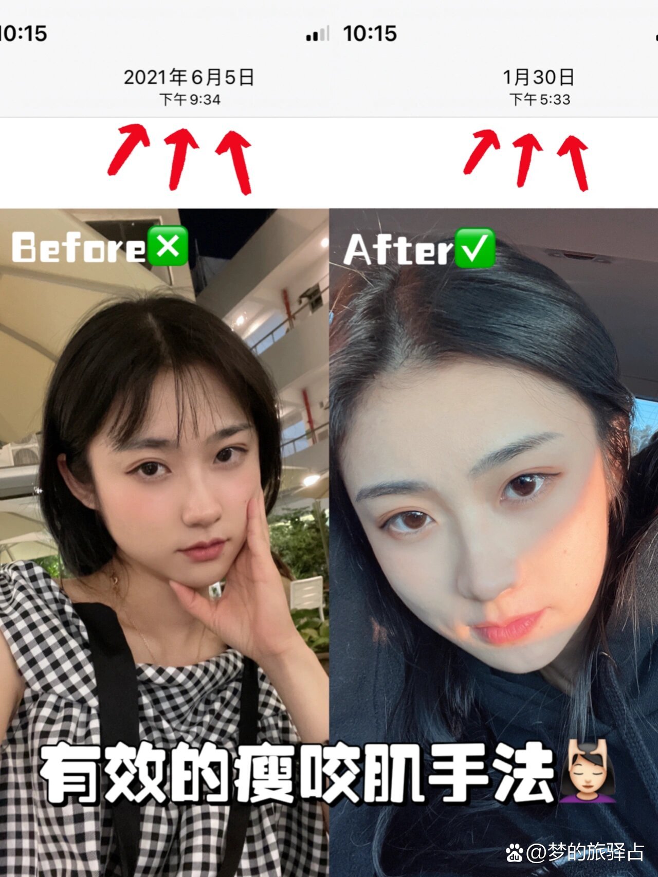 有效的瘦咬肌手法7491零成本瘦脸73