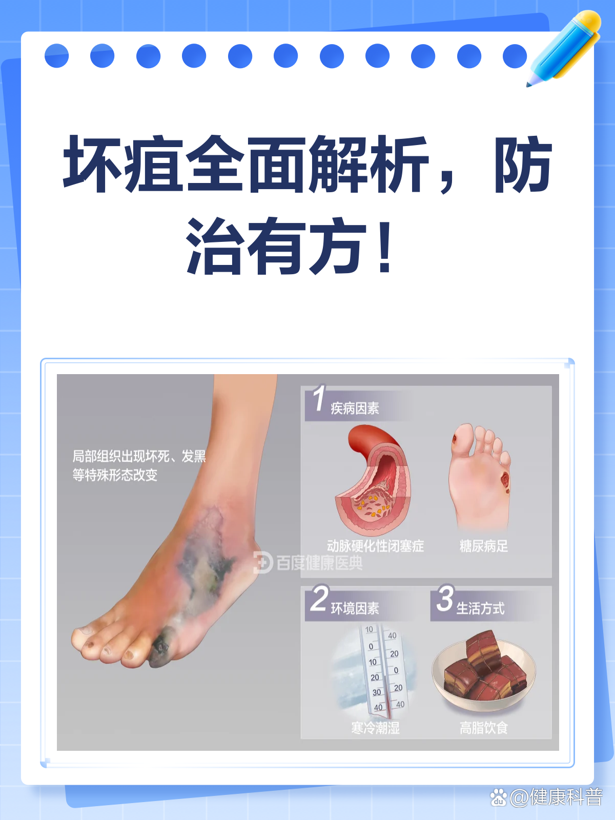坏疽来袭，了解它才能战胜它！