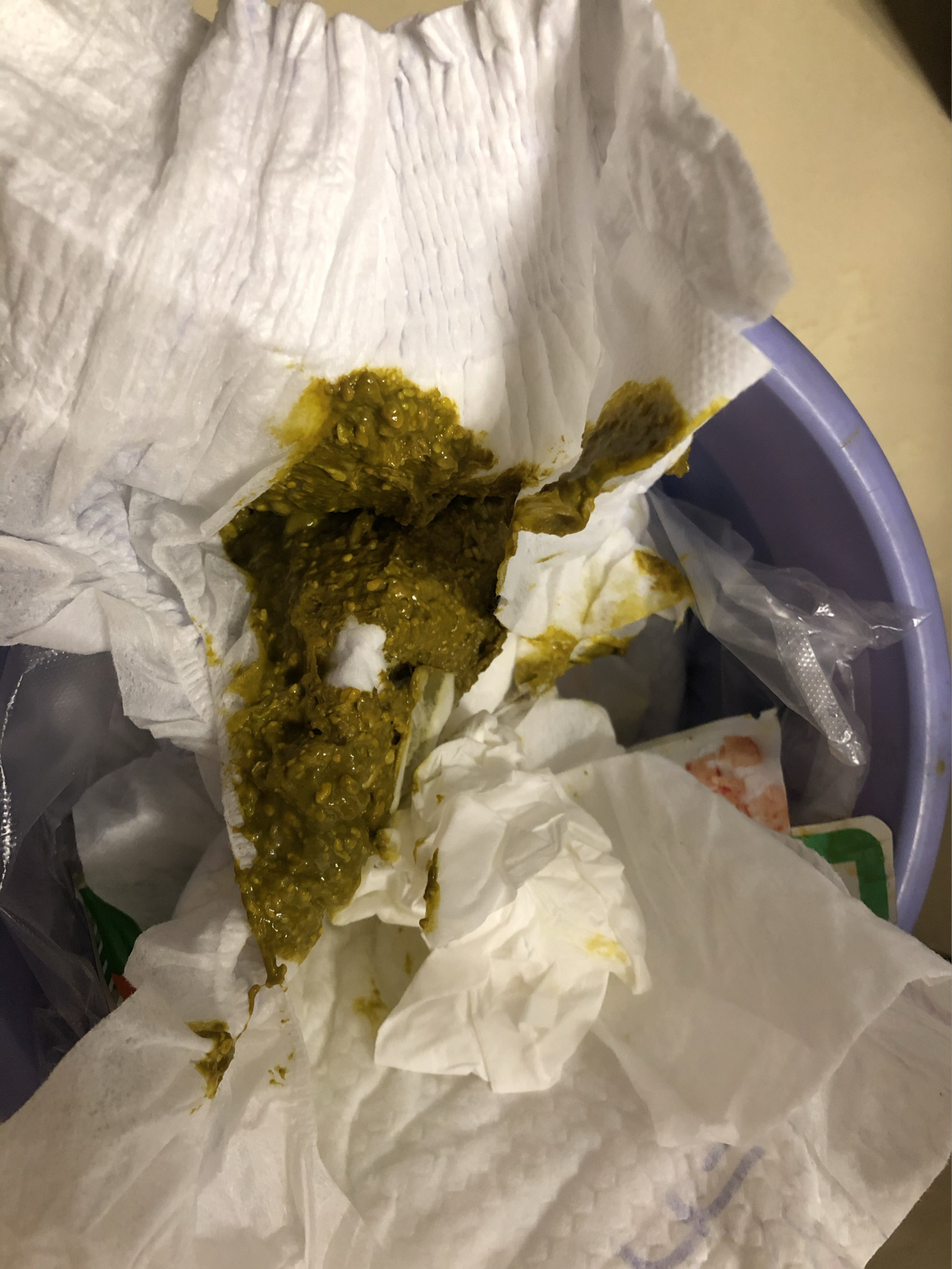 攒肚之后拉的大便颜色呈深绿色是怎么了?