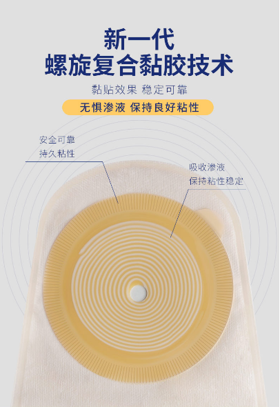 造口旁疝如何治疗?