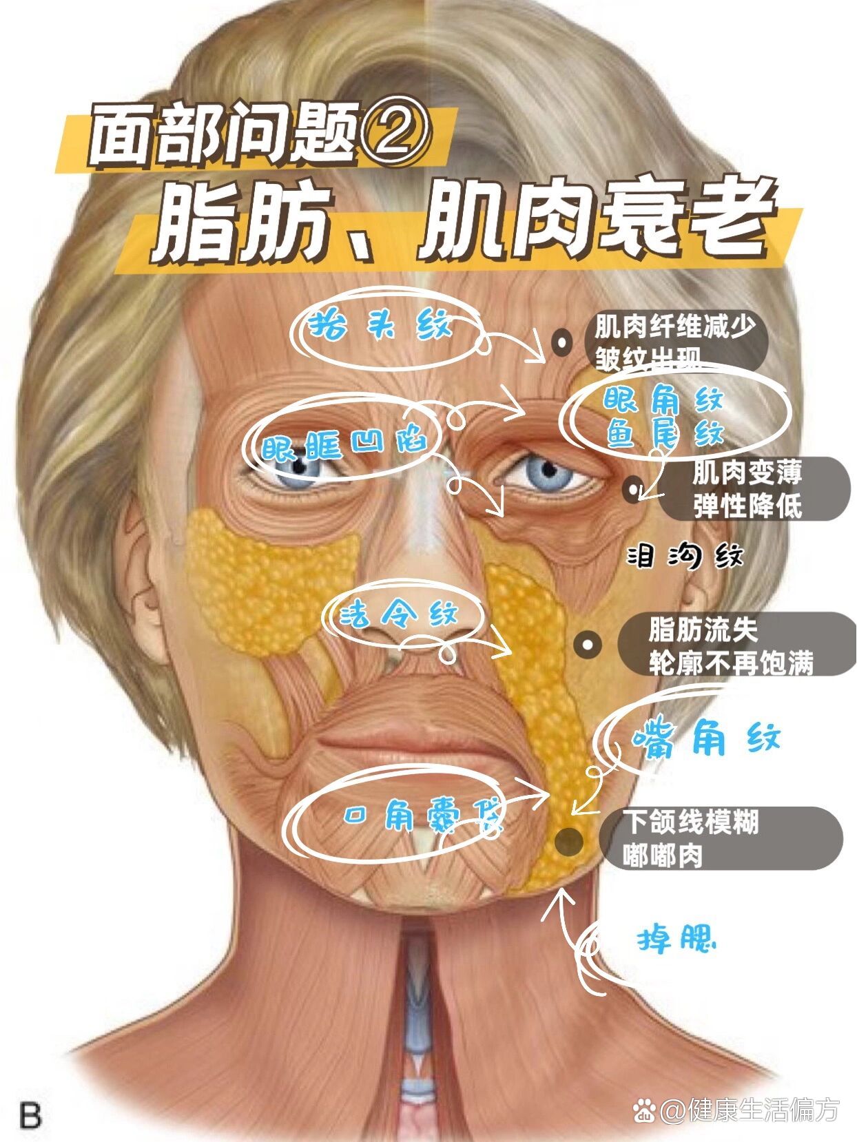 拨筋笔记🐾面部脂肪✝️肌肉和衰老的关系