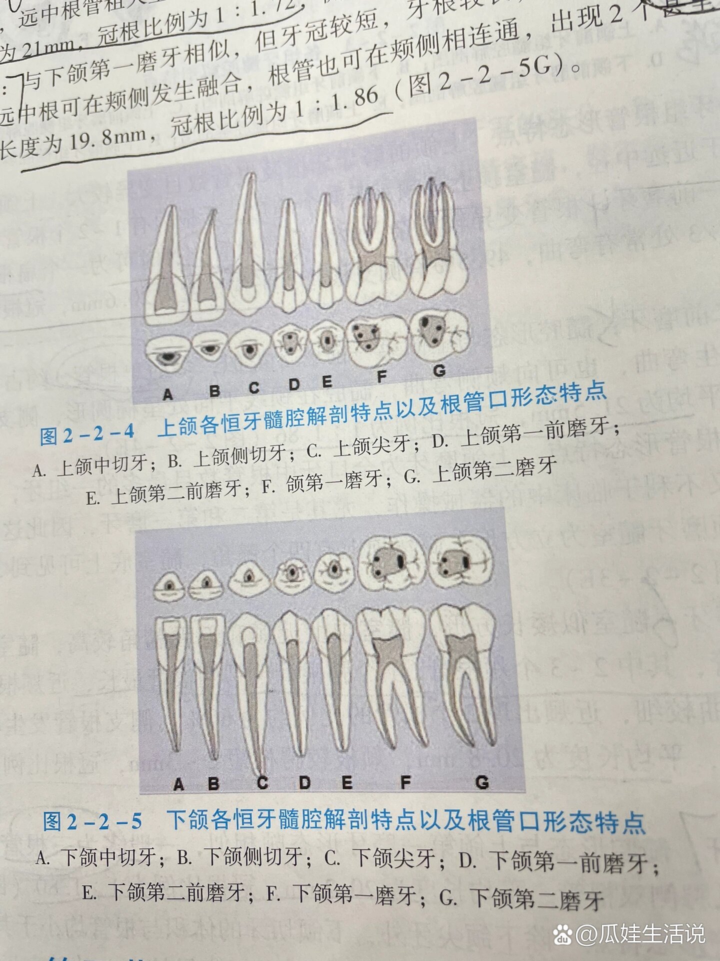 下颌中切牙髓腔形态图片