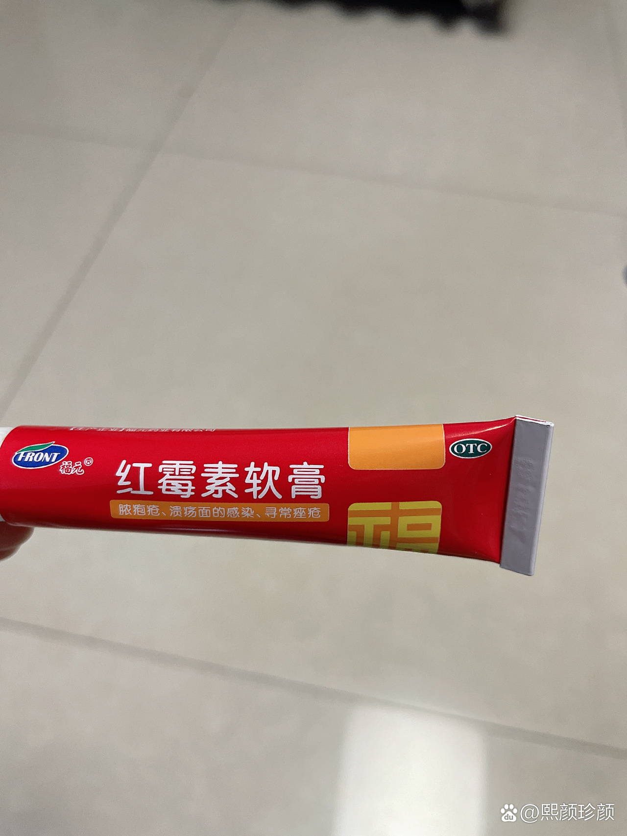 激光祛痣后红印可以涂红霉素软膏吗