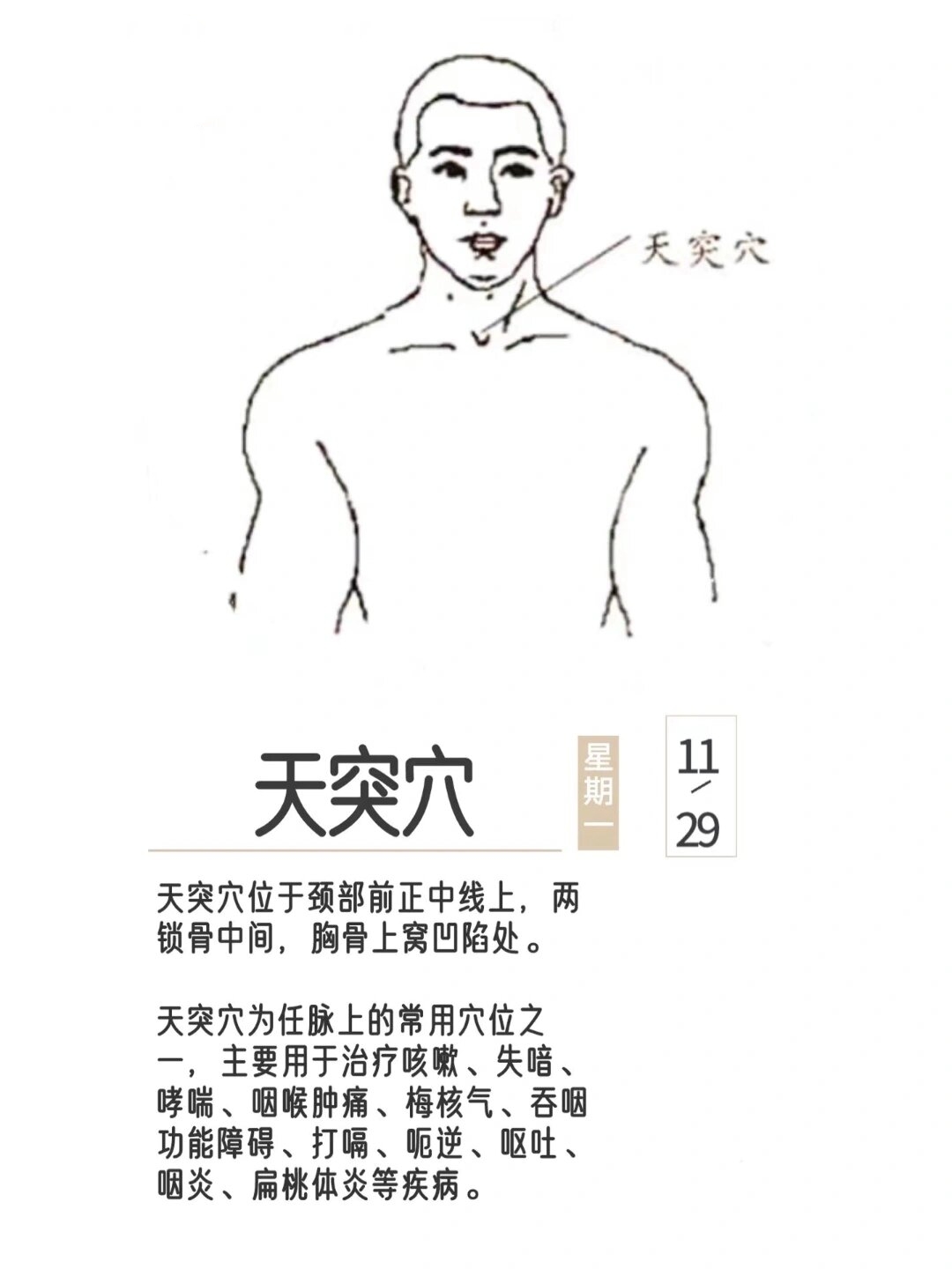 咽喉炎,失音,支气管炎等👉天突穴