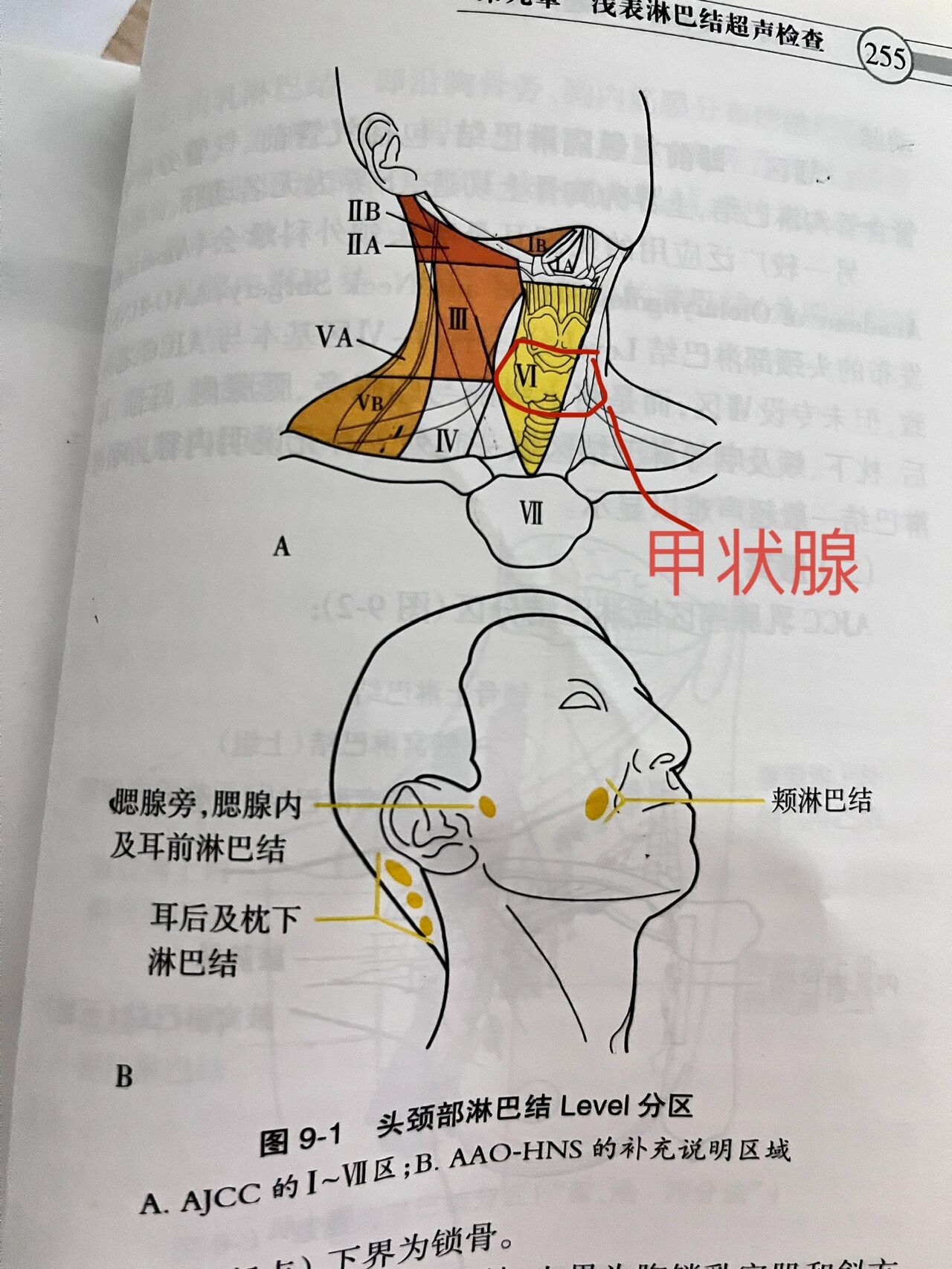 甲状腺分区图图片