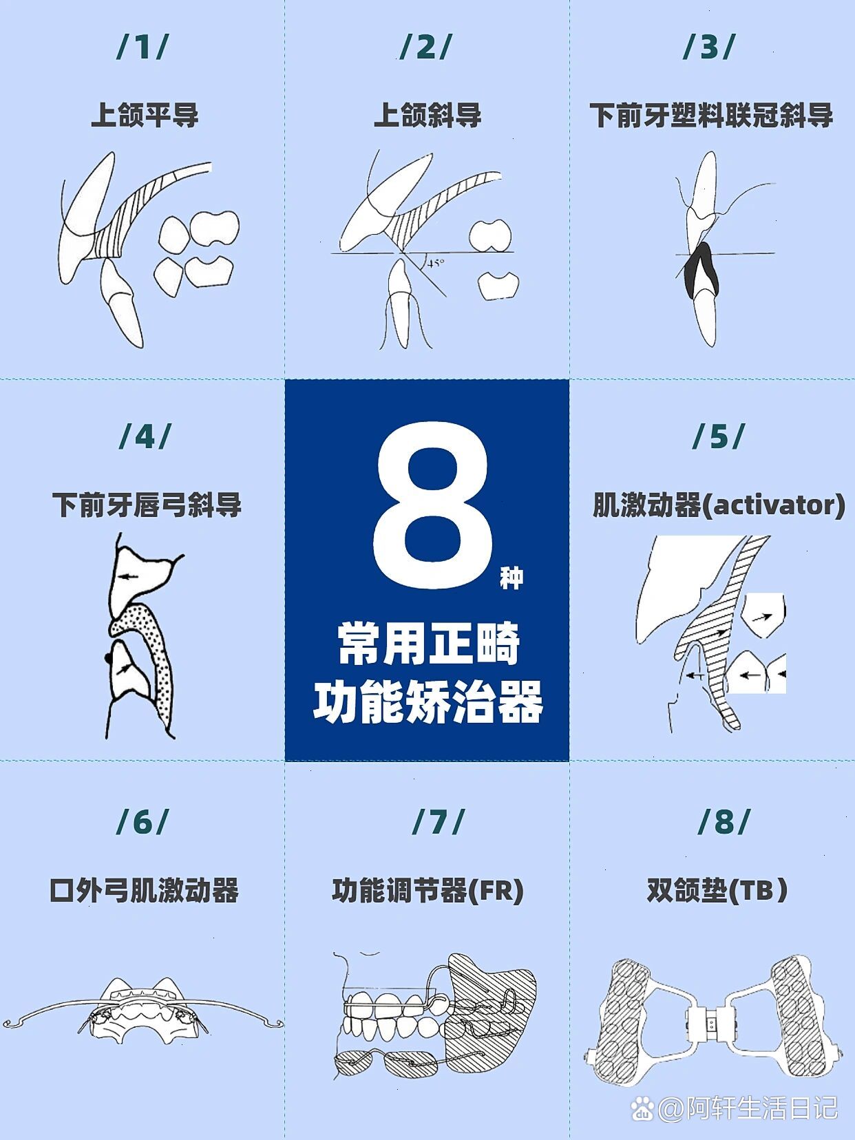 下颌联冠斜导图片图片