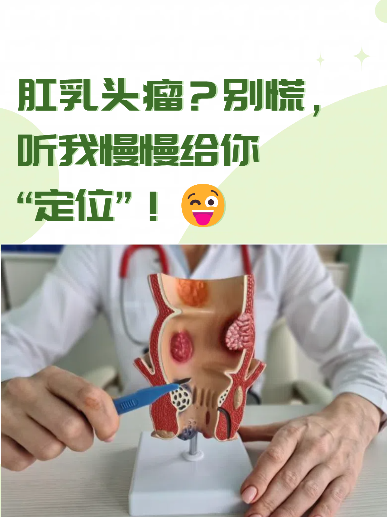 肛乳头瘤外痔图片