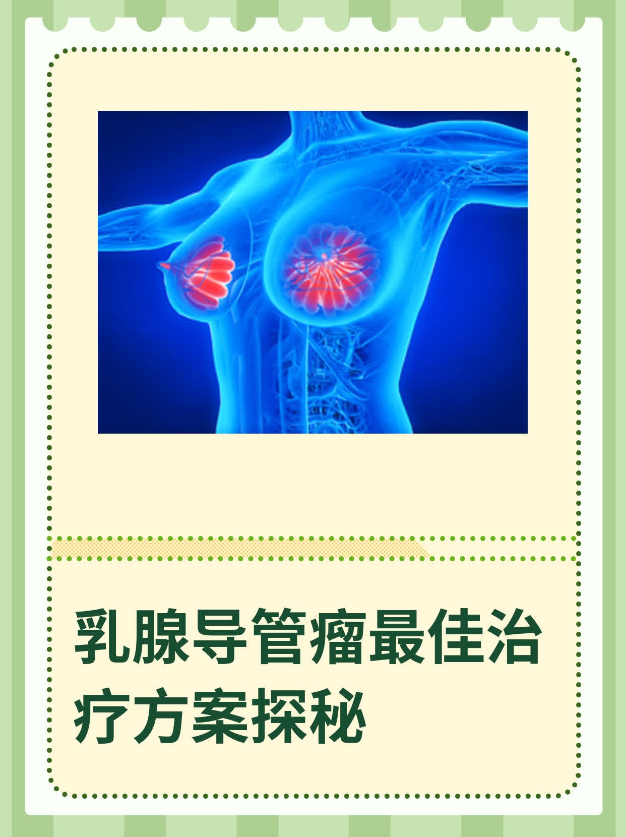 乳腺导管瘤的真人图片图片