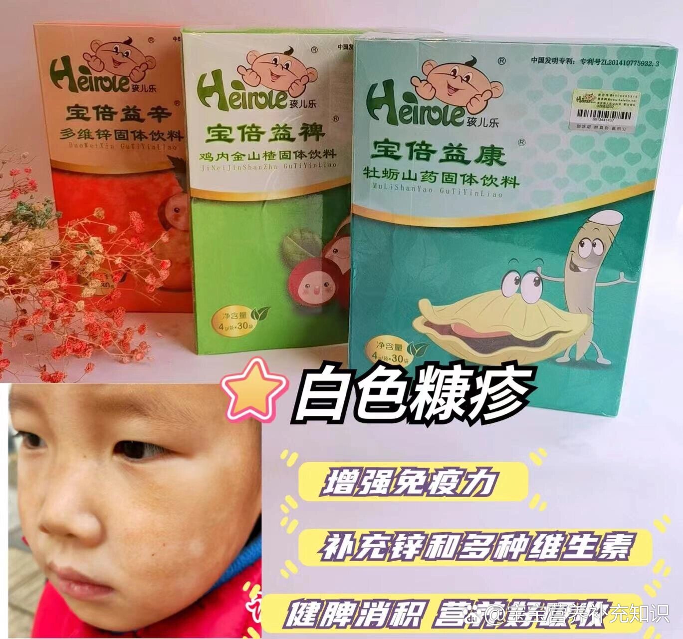 肤色不均,这里白一块那白一块,看起来像癣又不是癣,出现这种情况,宝宝