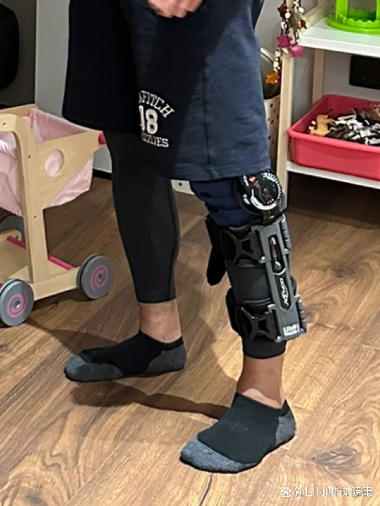 前交叉韧带损伤的保守治疗
