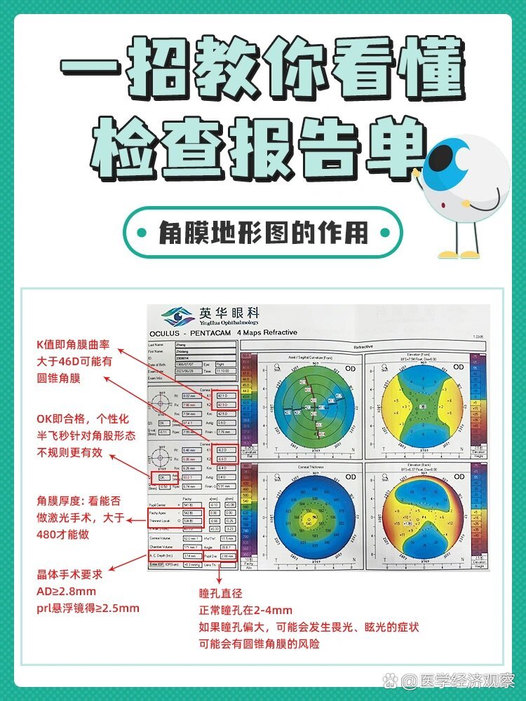 角膜地形图上看kappa角图片