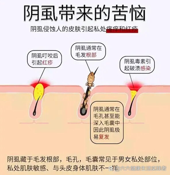 5到2毫米左右