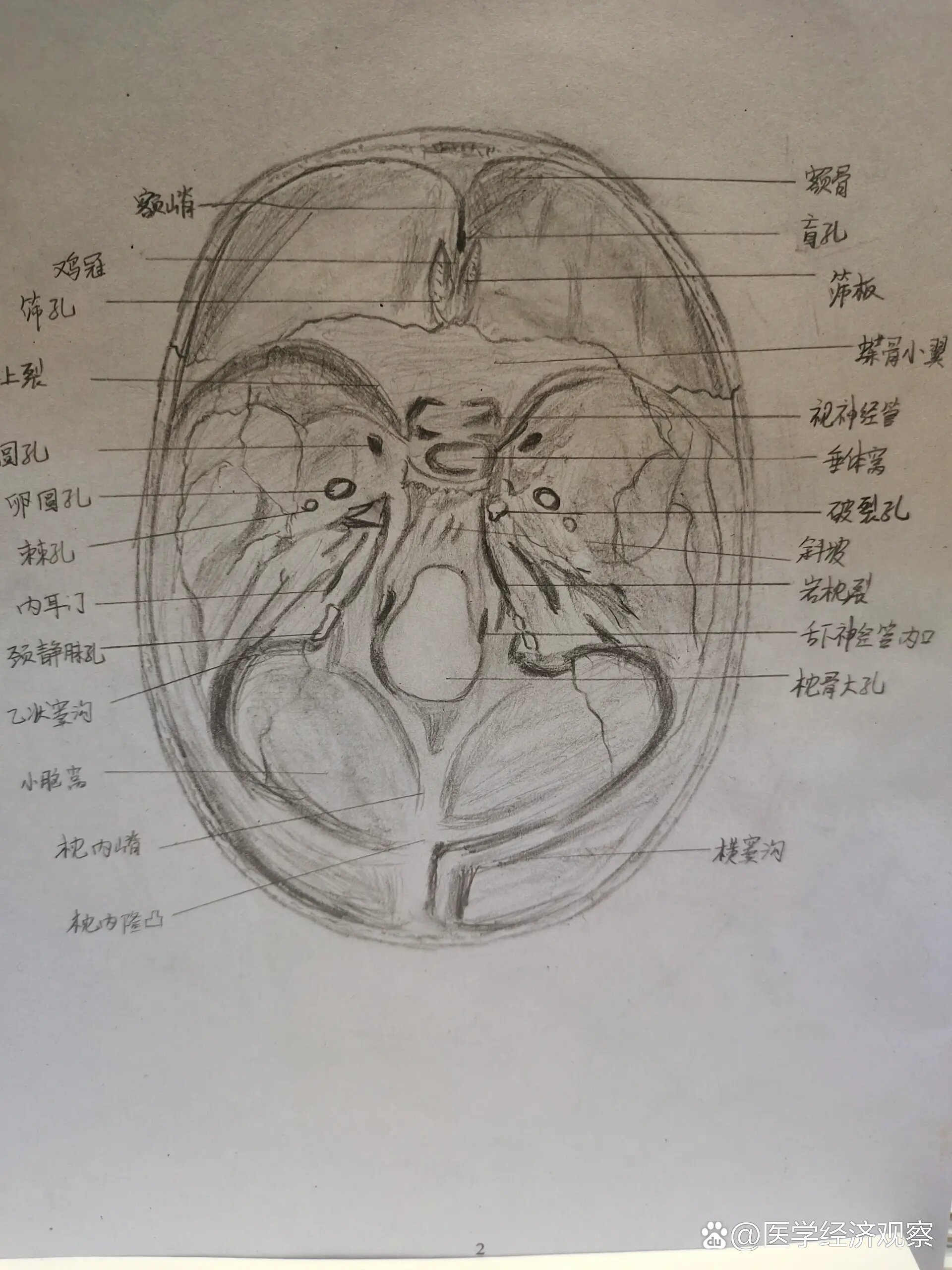 颅底内面观图片图片