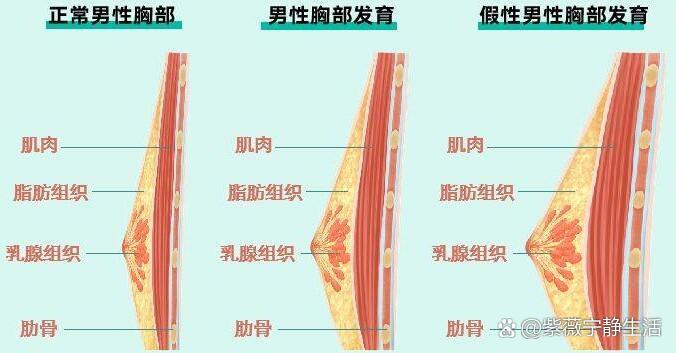 男性身体雌化图片