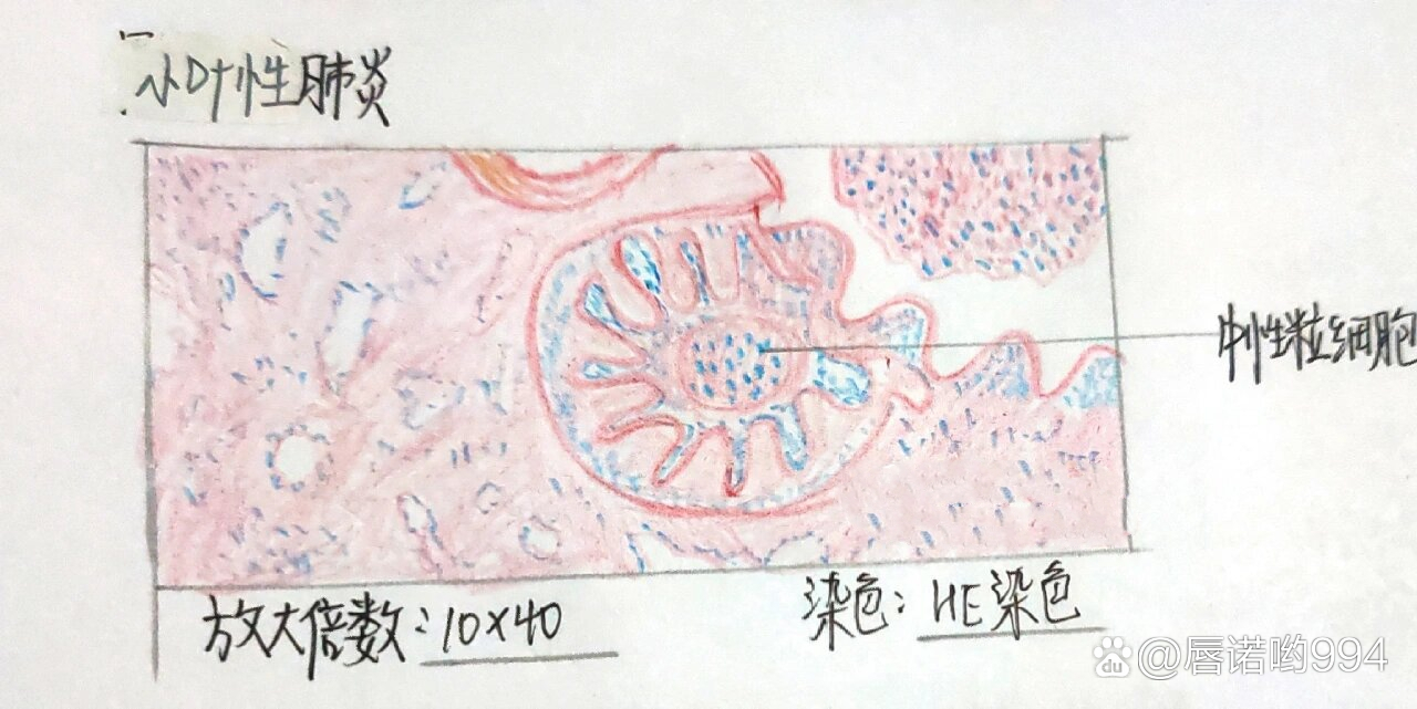 肺炎杆菌手绘图图片