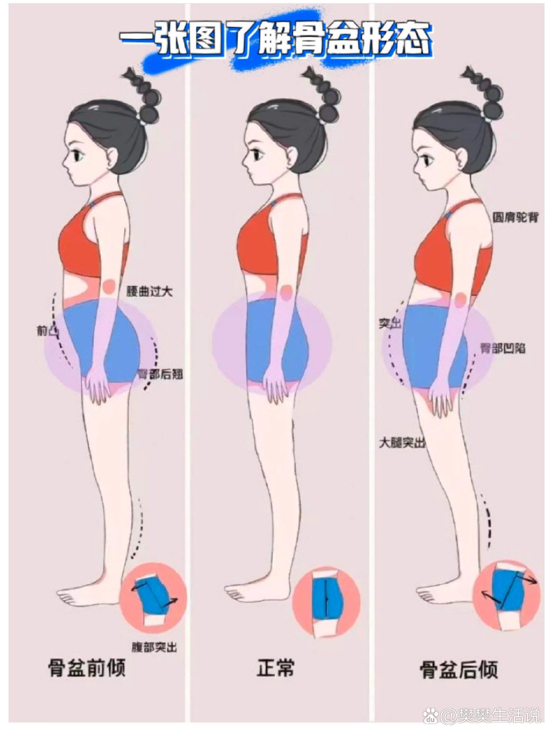 骨盆入口左斜径图片图片