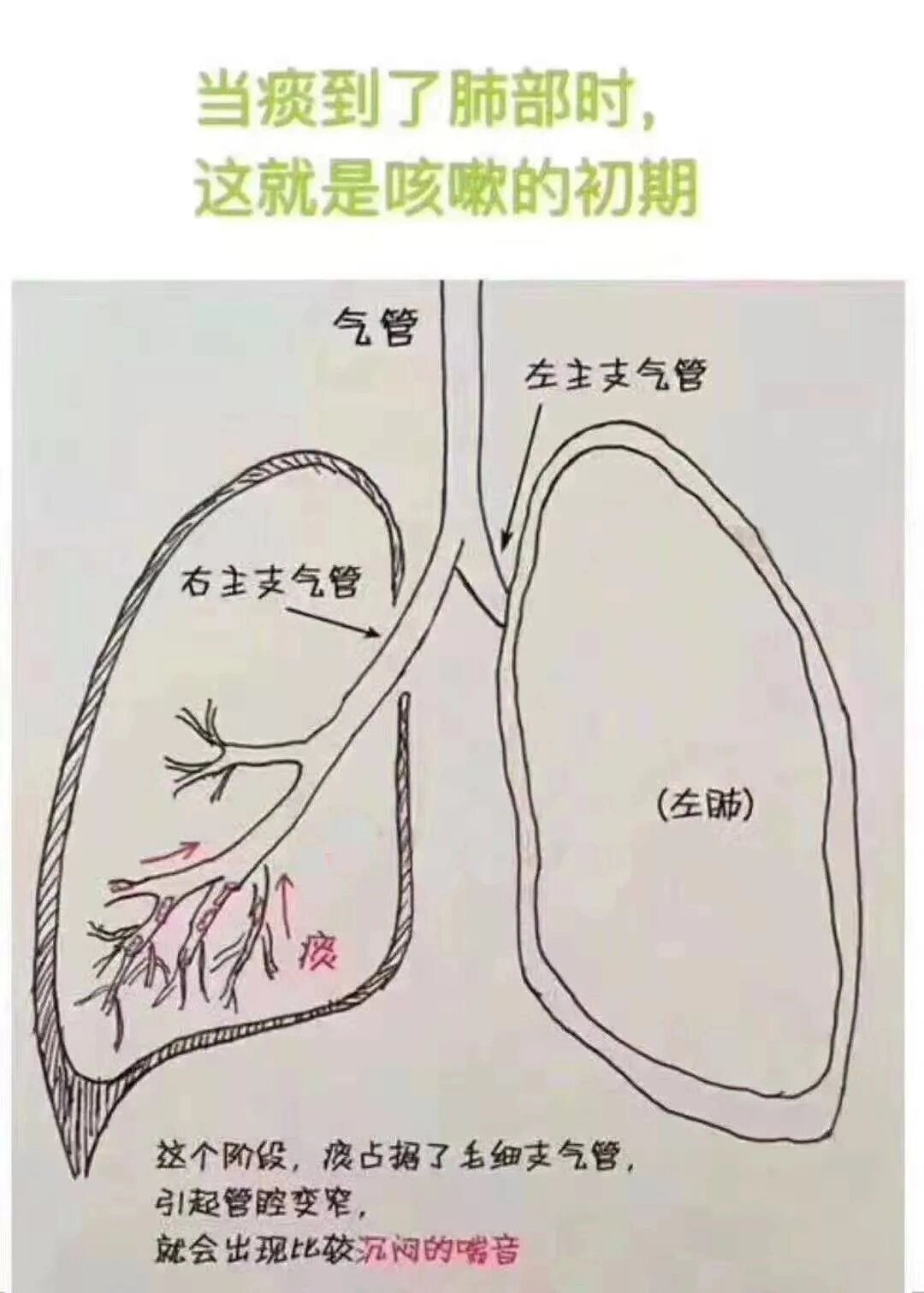 ✅健康知识分享�咳嗽四个阶段