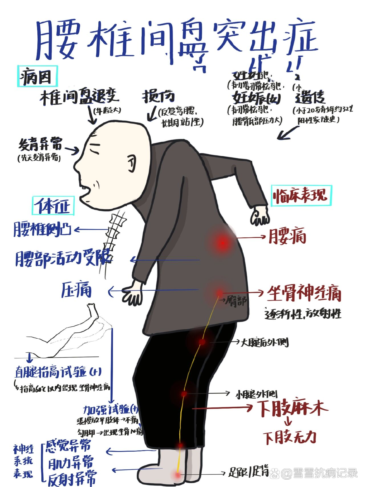 腰椎骶化图片原因图片