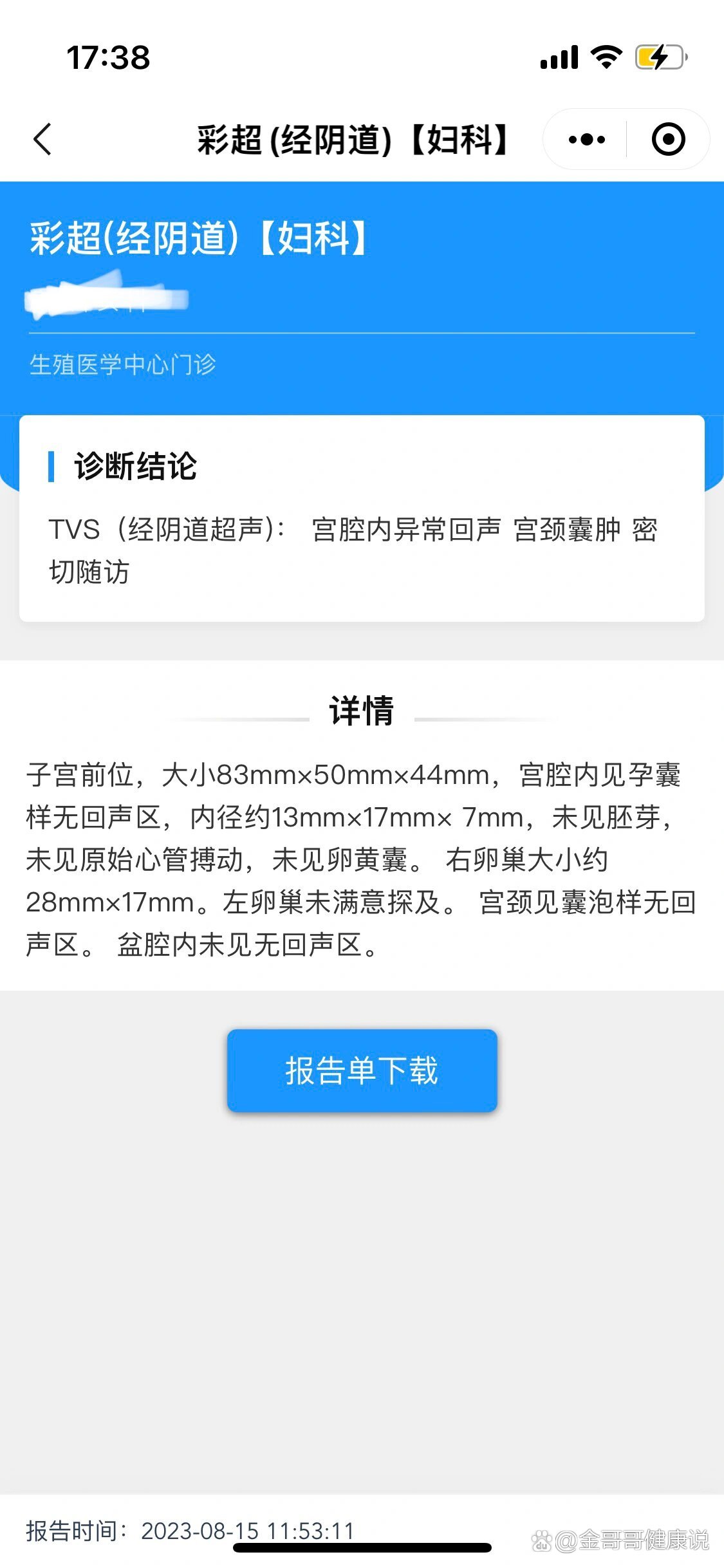 冻囊胚移植第三天(冻囊胚移植第三天没感觉是不是没成?)
