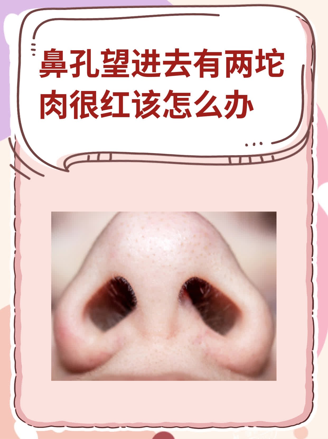 鼻孔望进去有两坨肉很红该怎么办