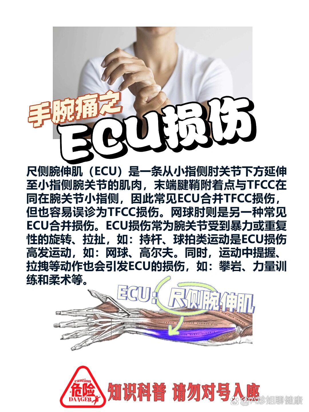 尺侧手腕痛图片