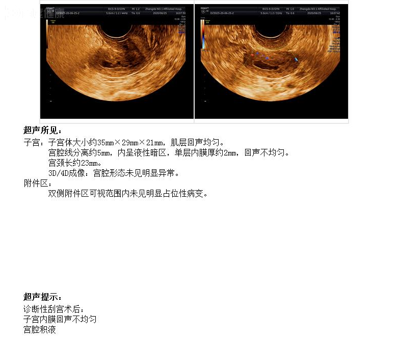 子宫内膜癌诊刮物图片图片