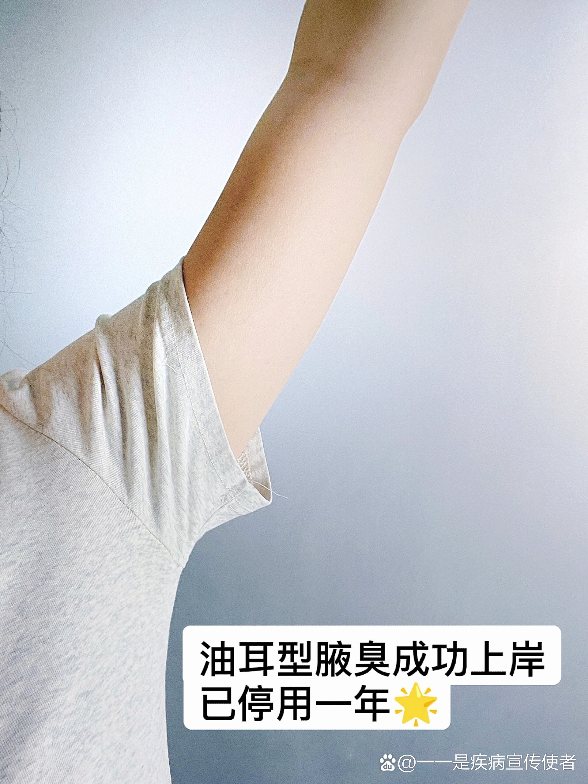 油耳型狐臭成功上岸!