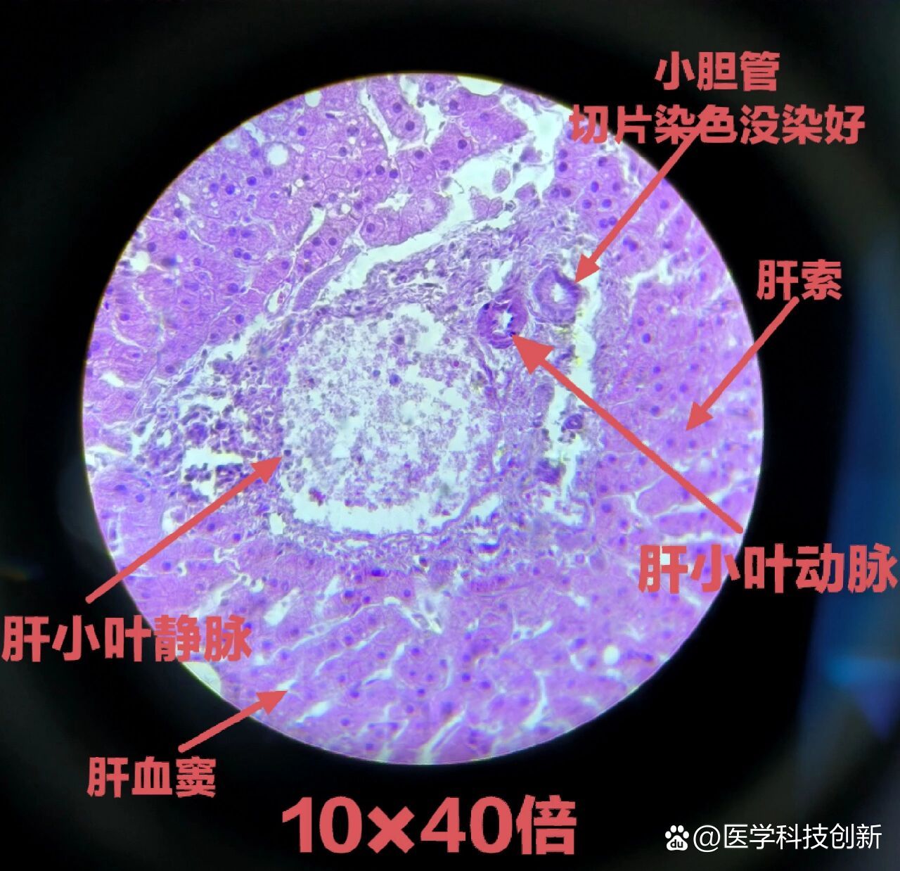 肝小叶高倍镜模式图图片