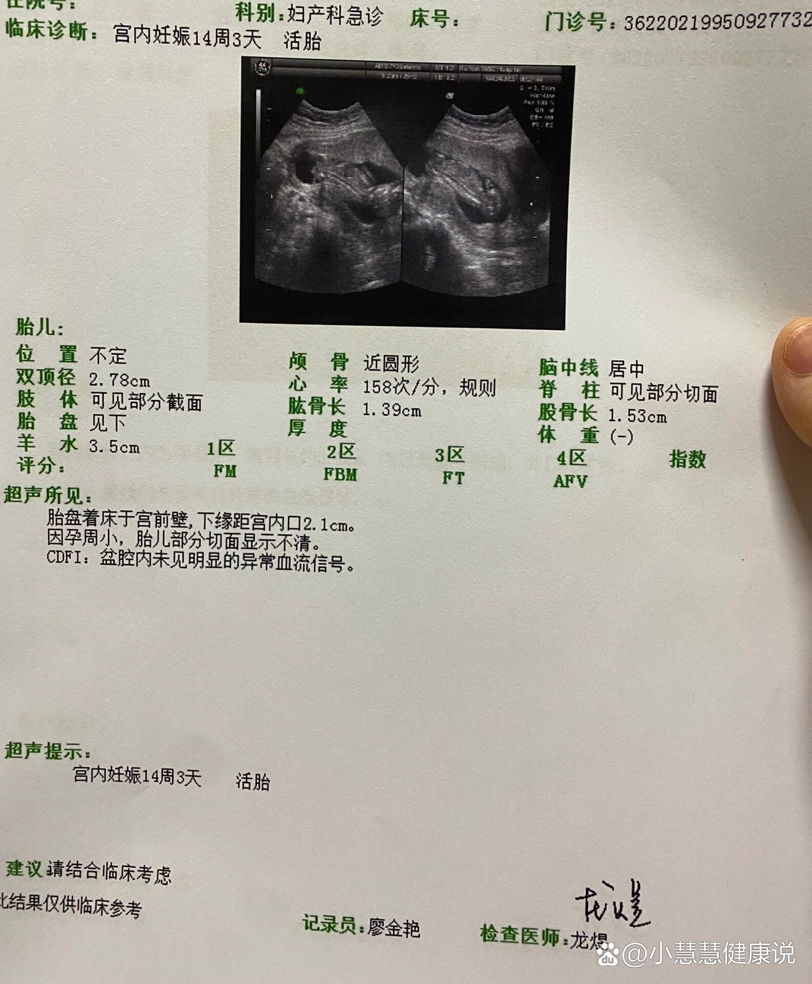 孕14周加腰酸引起肚子姨妈感是什么原因啊