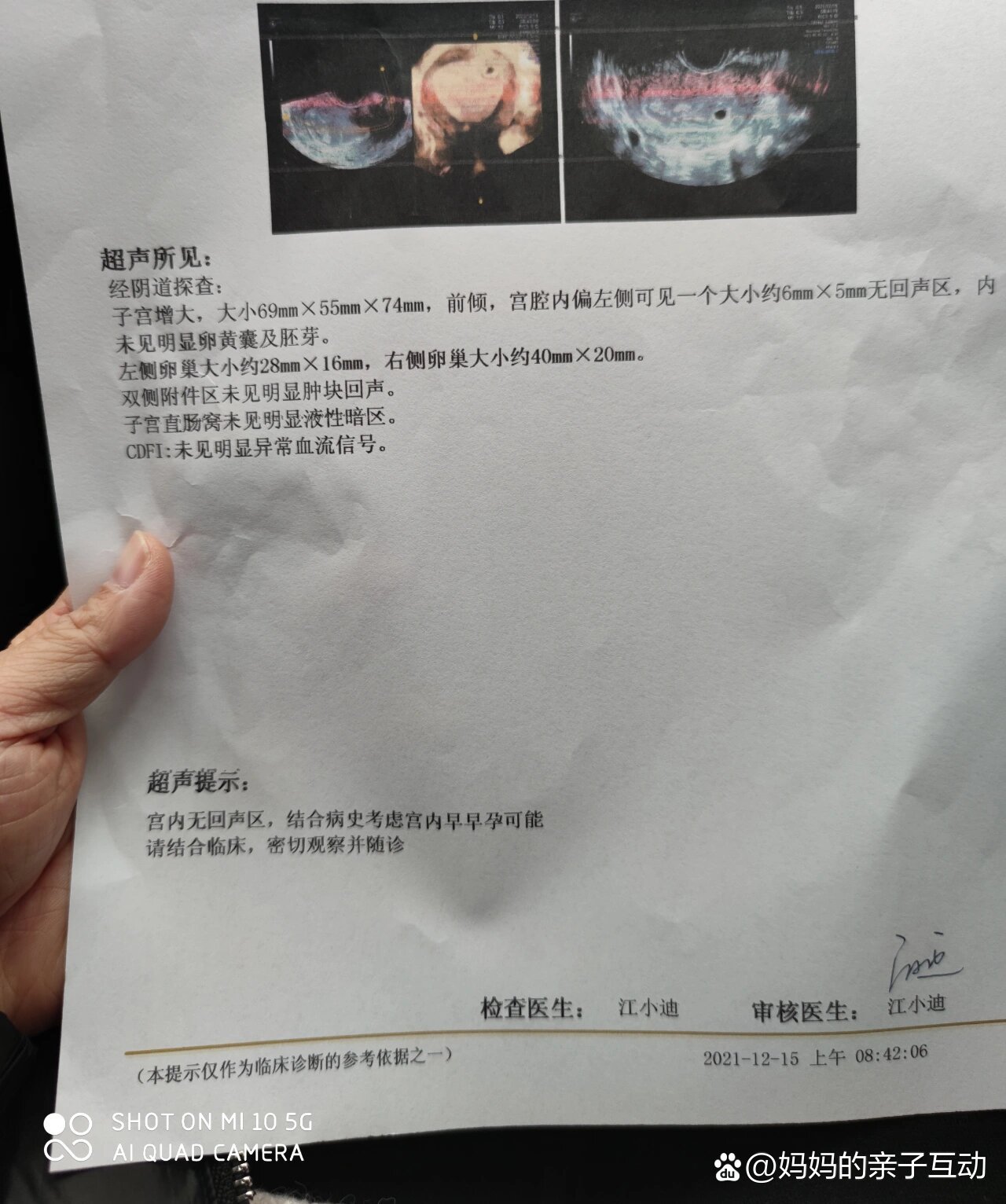 医生说胚胎不行了不知道能不能自然流掉
