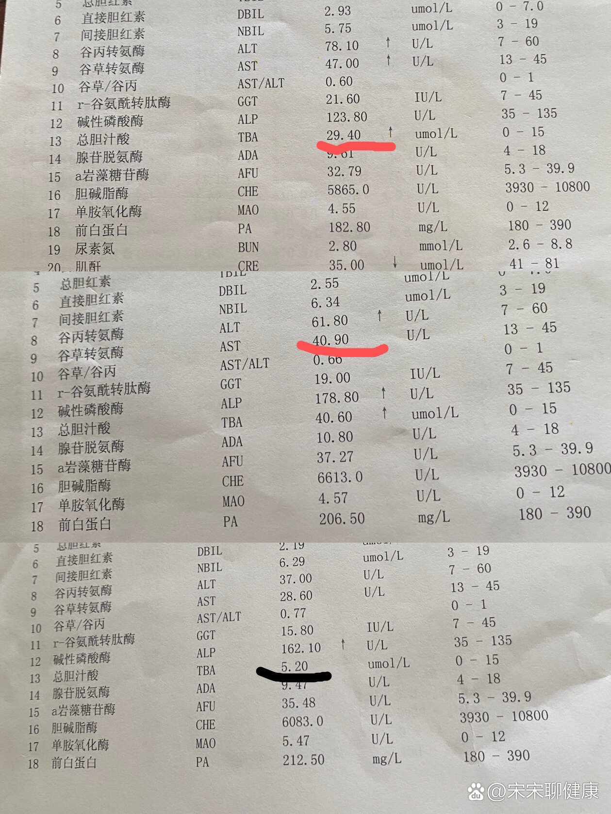 总胆汁酸高图片