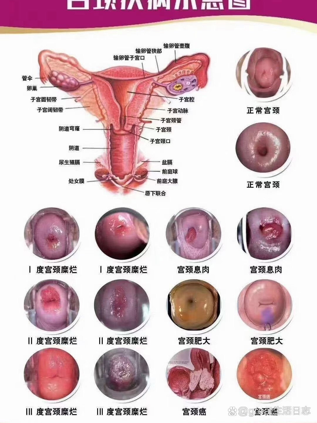 你的宫颈是不是也会像脸一样去保养?