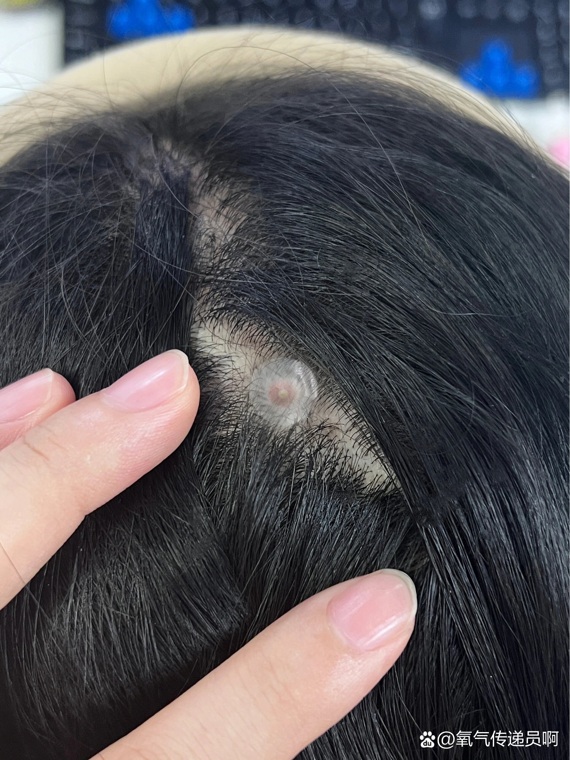 头顶出现这种东西!