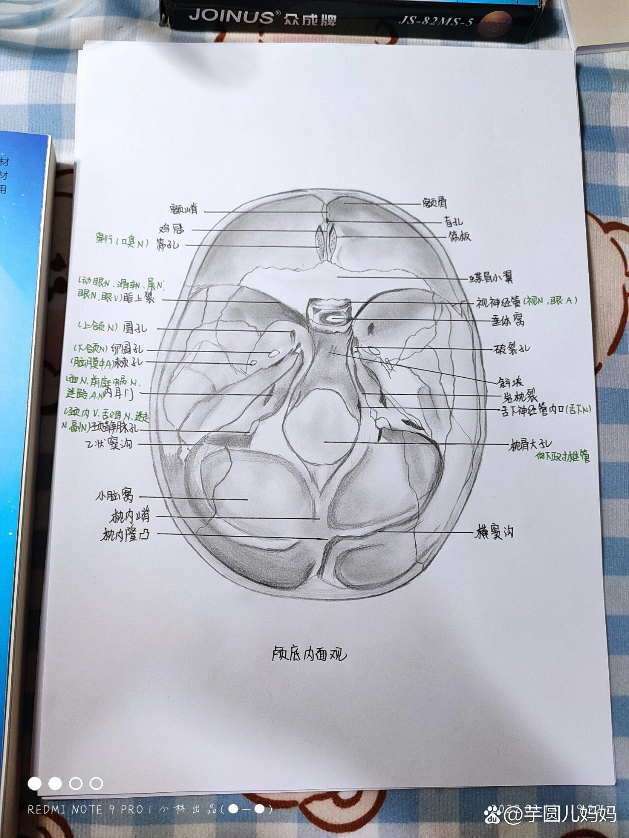 颅底内面观图片图片