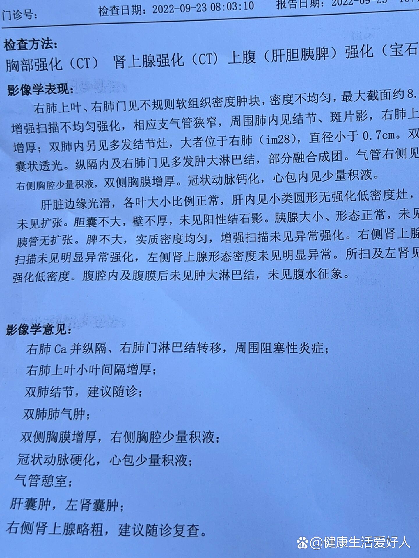 肺癌单子图片图片