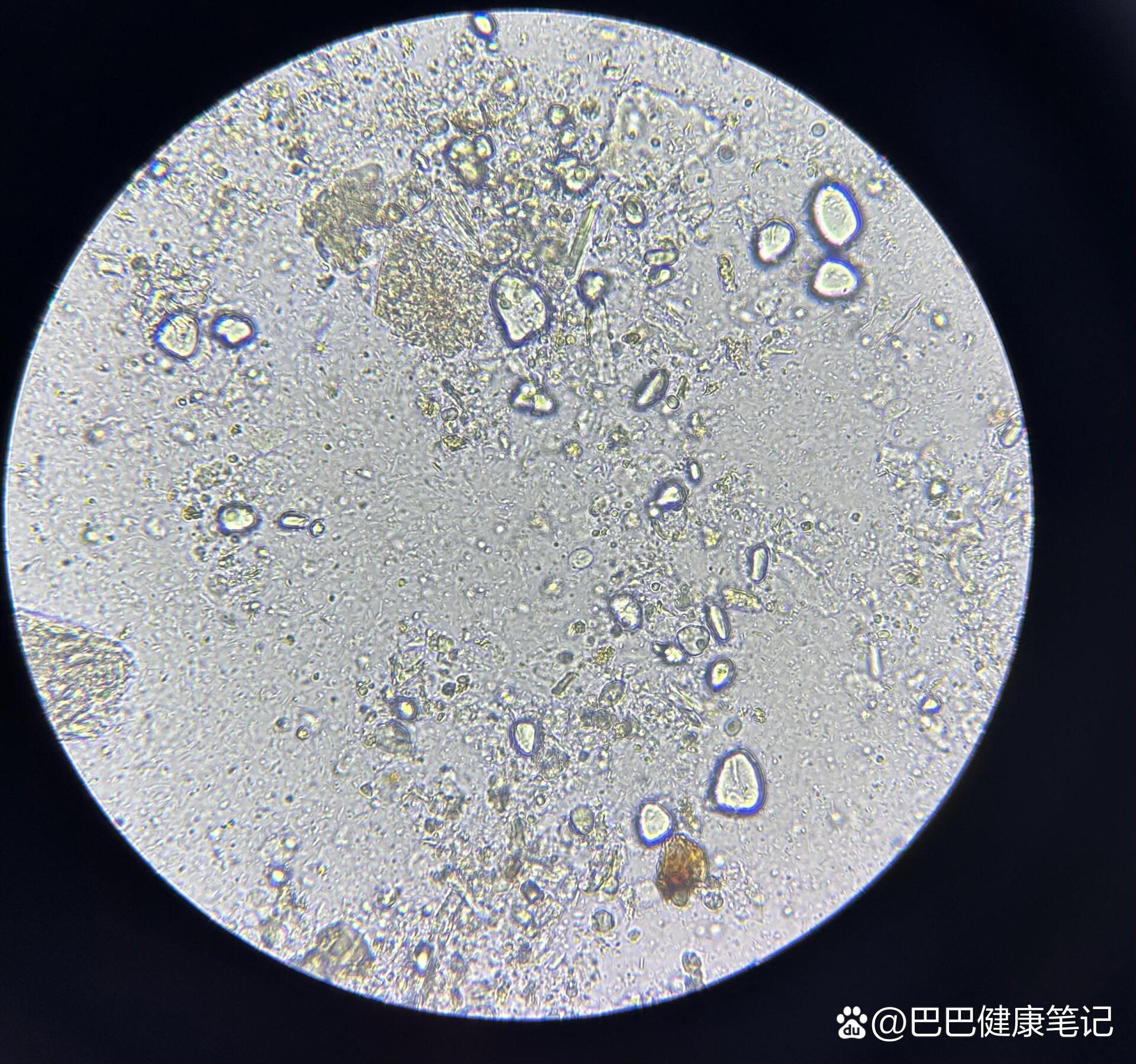 不会还有人不认识三毛滴虫吧