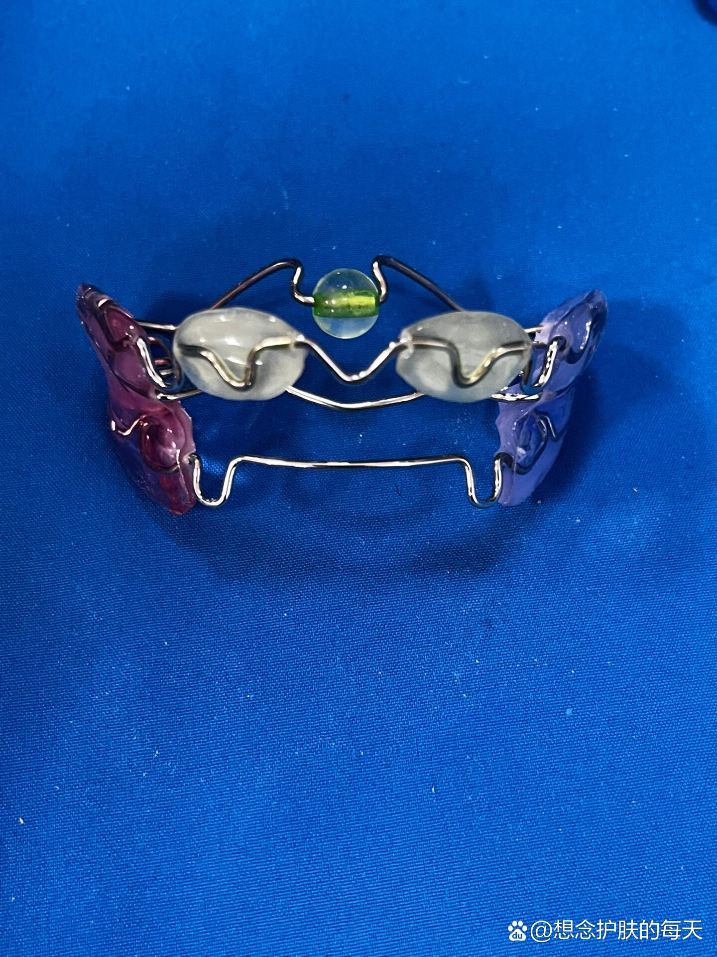 儿童牙齿早期干预矫治器也是需要家长们了解到的,比如法兰克frankel