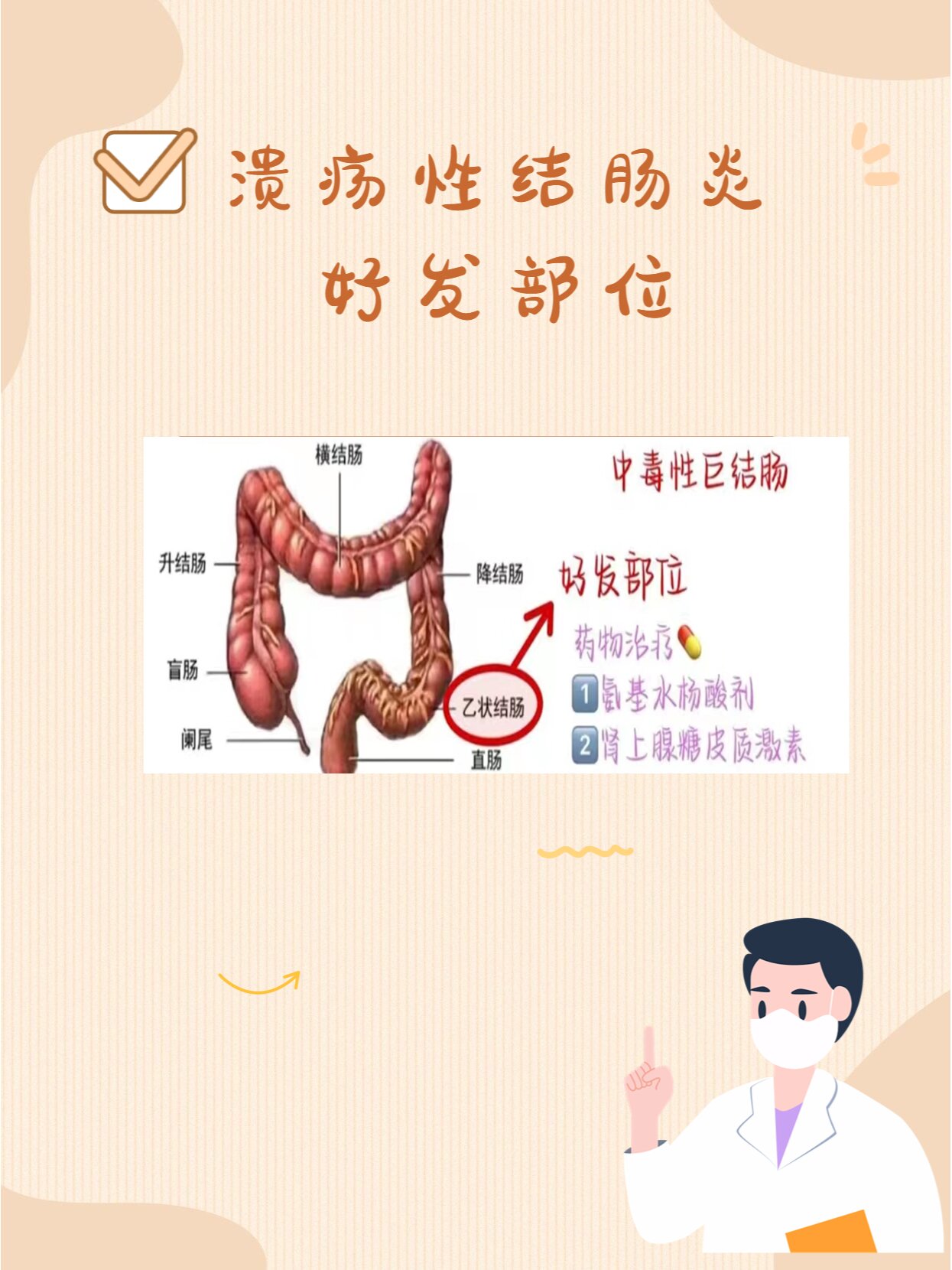 你知道溃疡性结肠炎好发在哪里吗?
