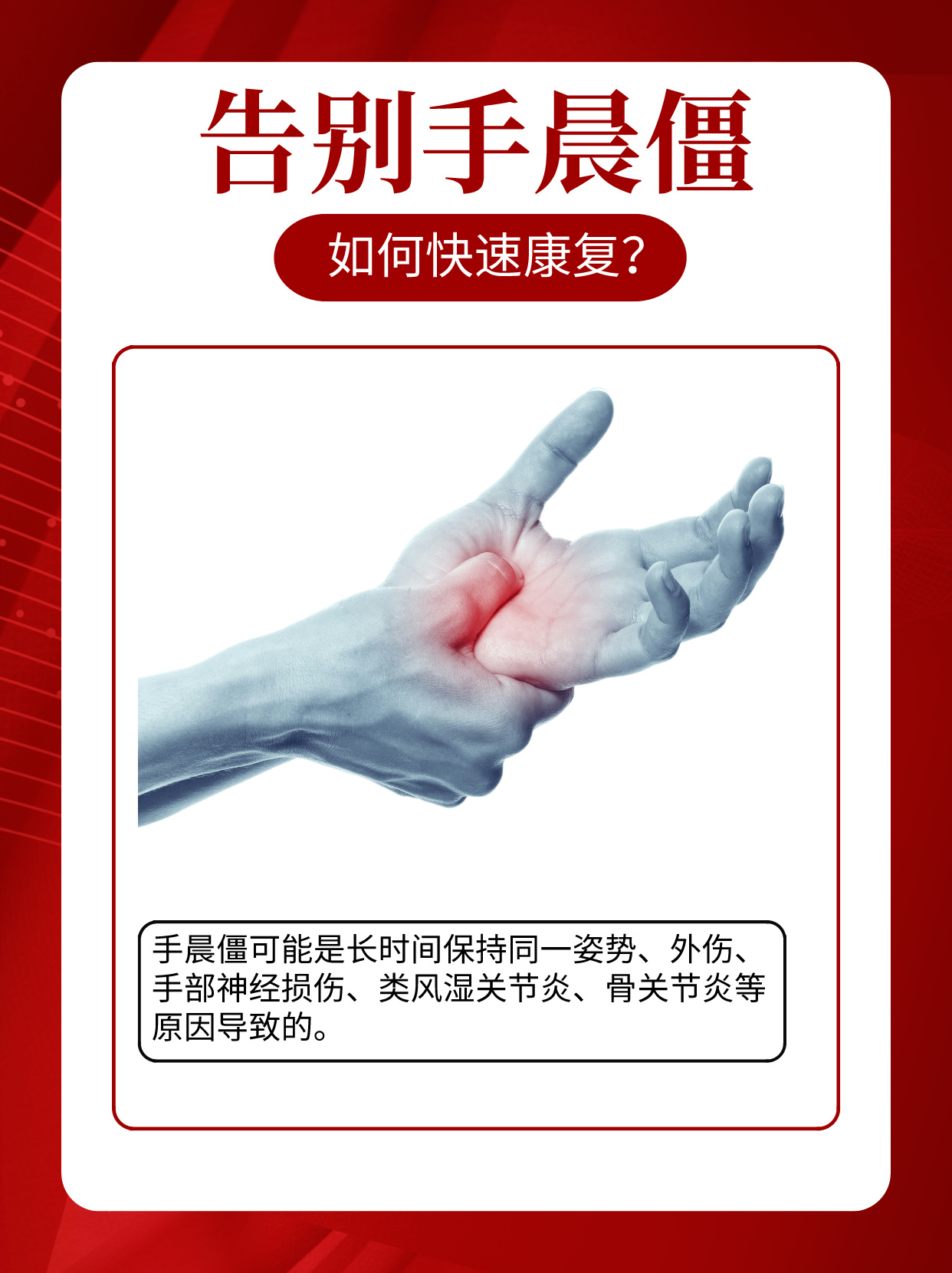 告别手晨僵,如何快速康复?