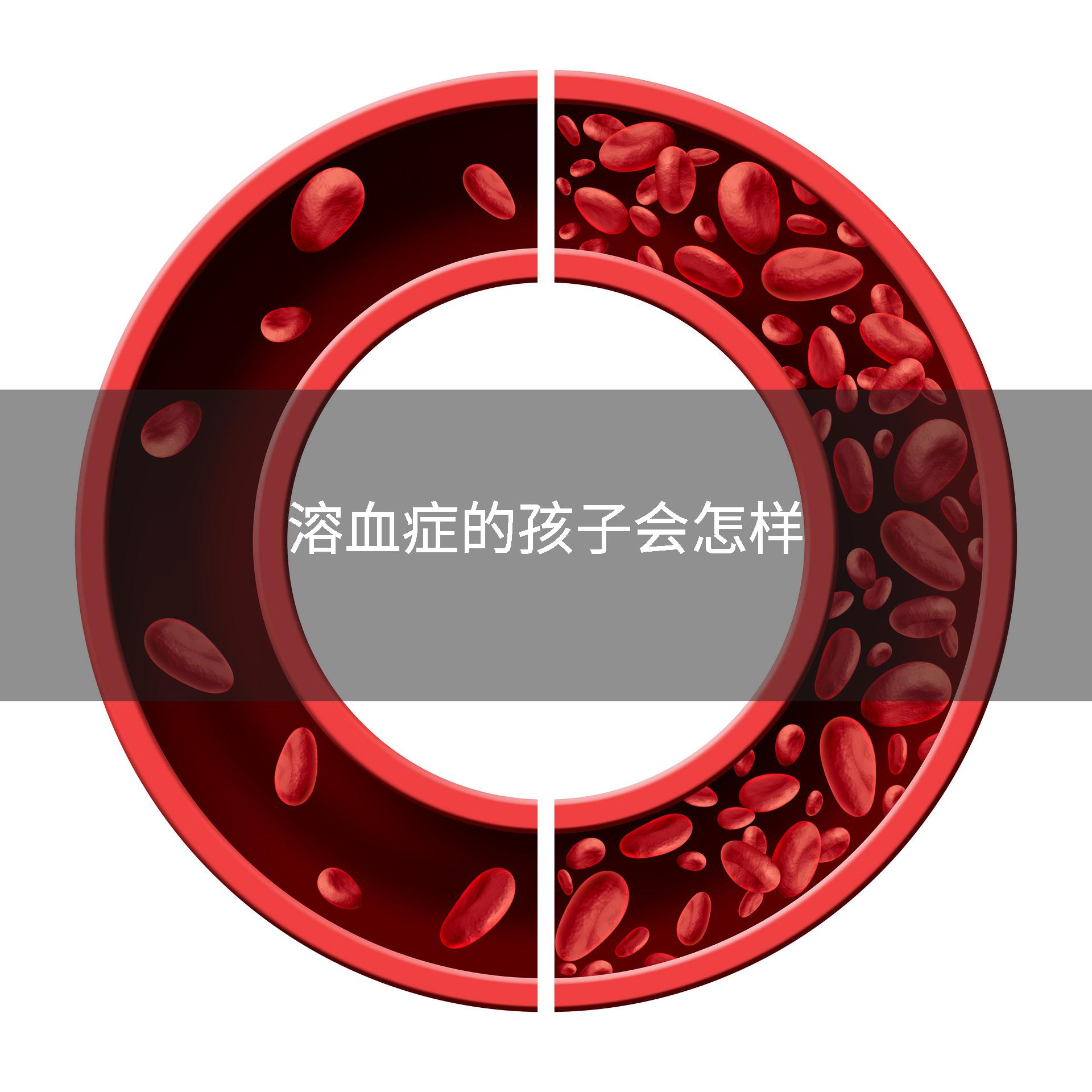 溶血症的孩子会怎样