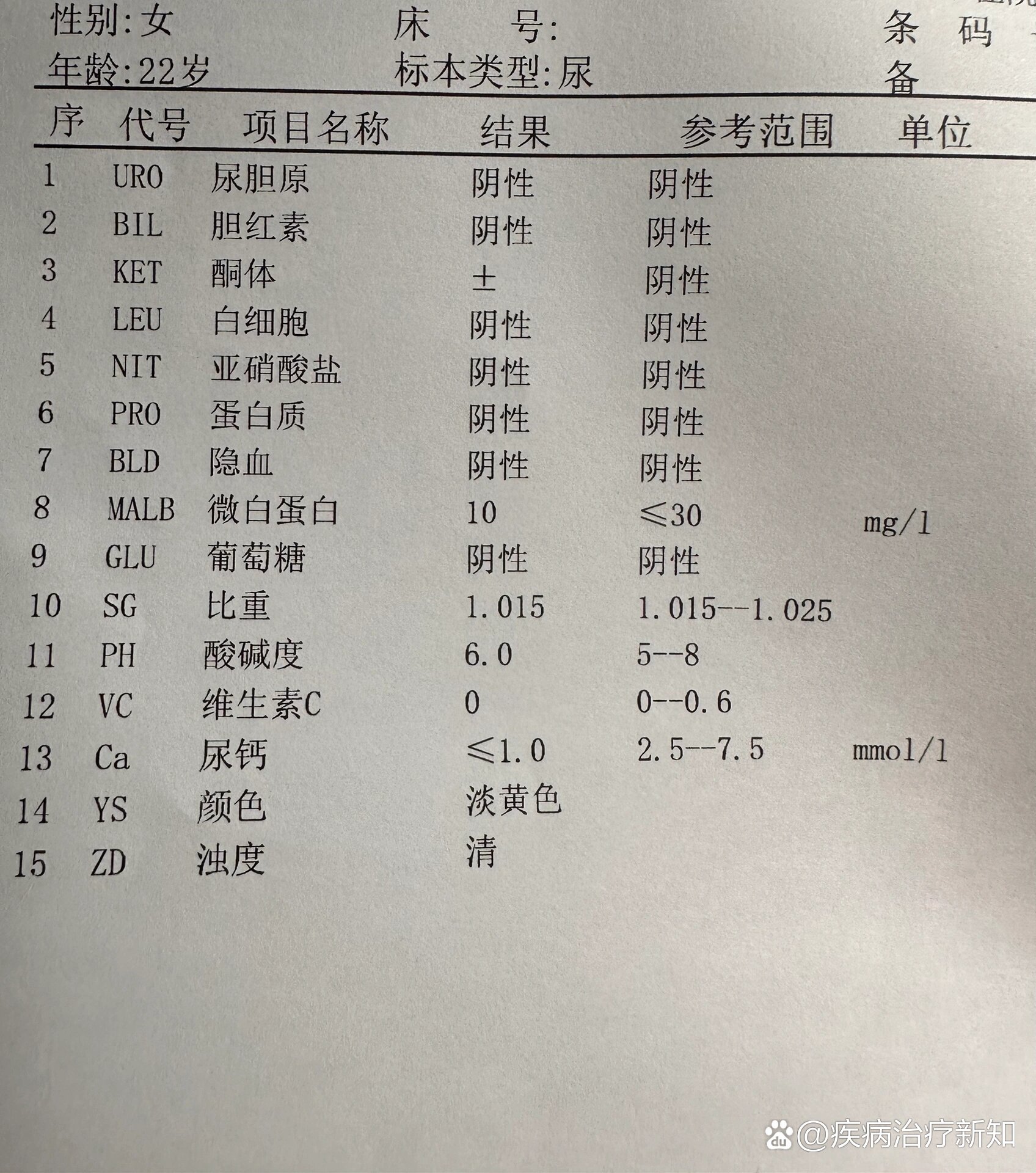 尿微量白蛋白80图片