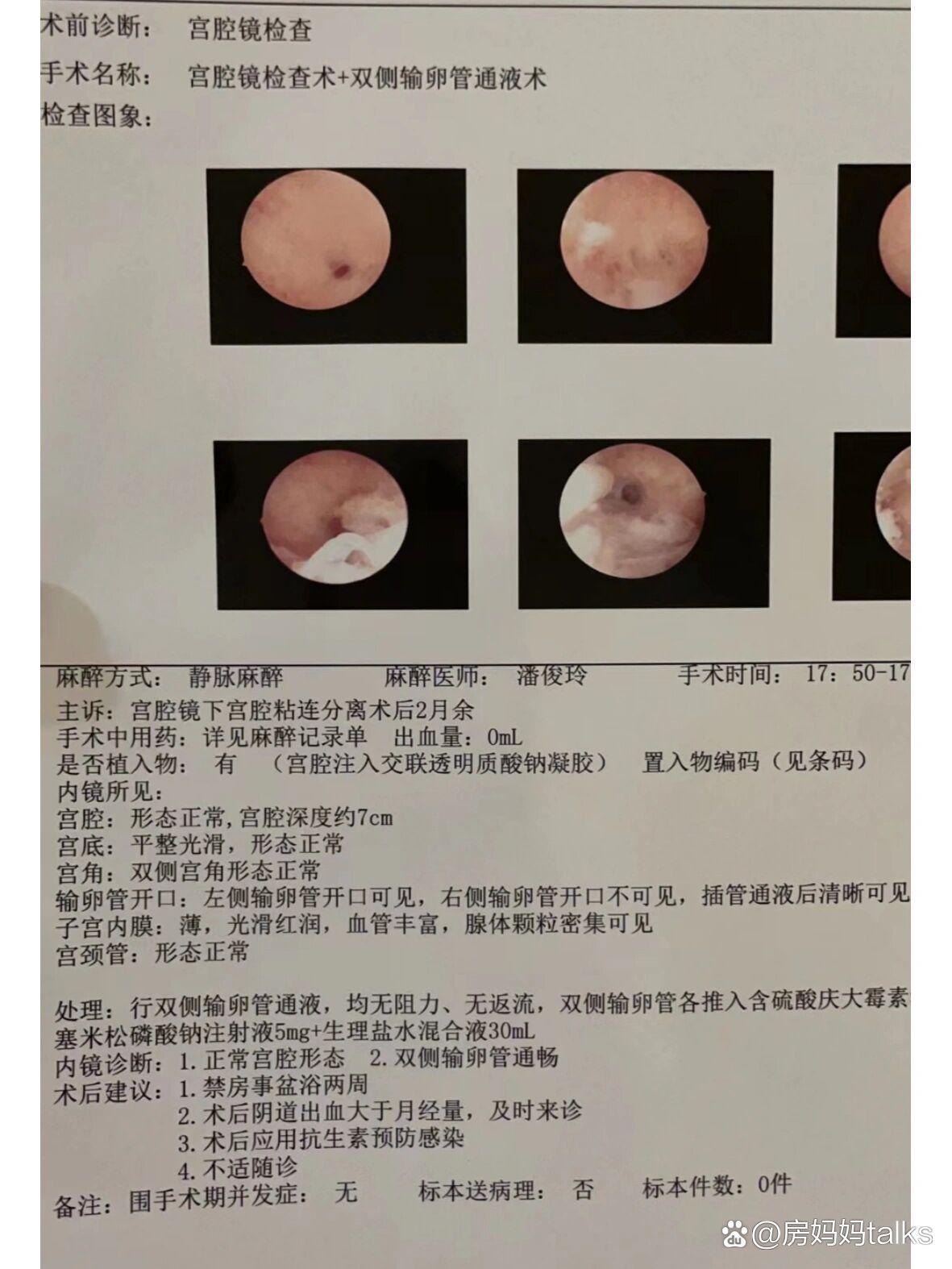 宫腔粘连,影响怀孕吗?