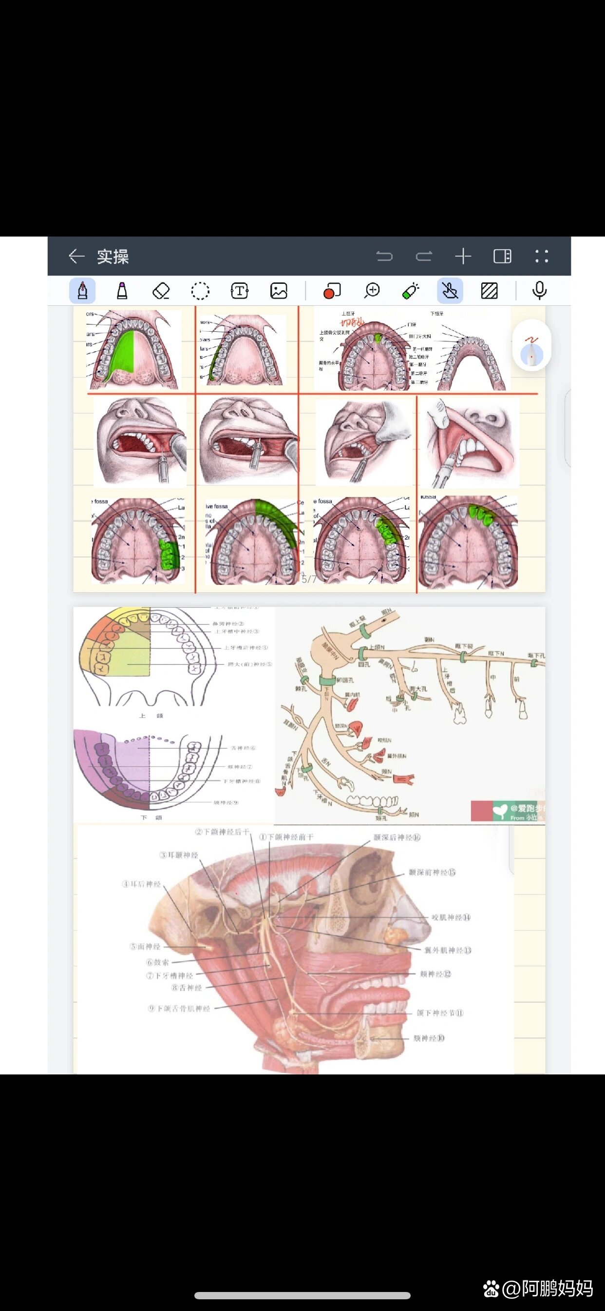 口腔局麻常用药物以及进针位置目标