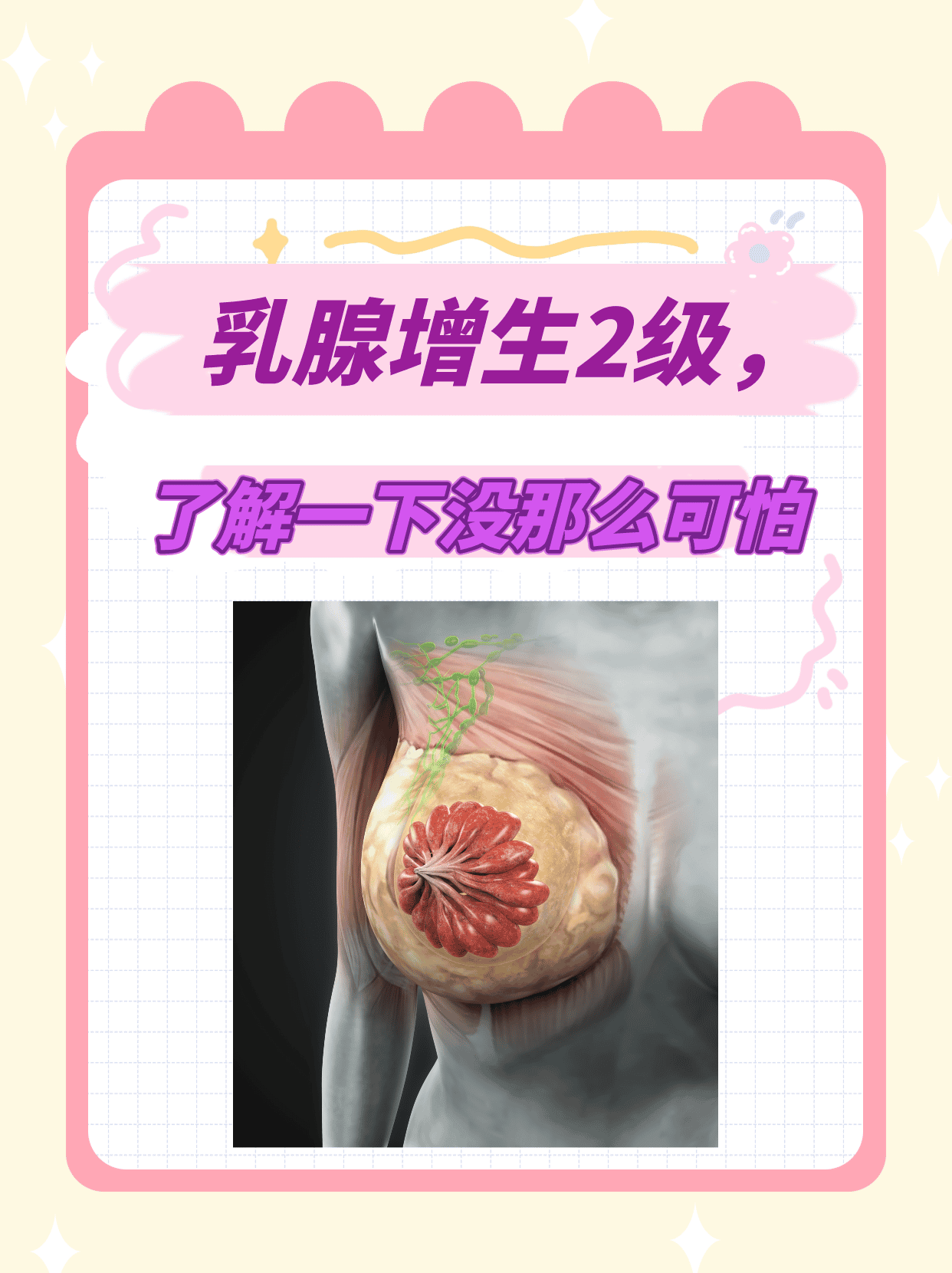 重度乳腺增生图片