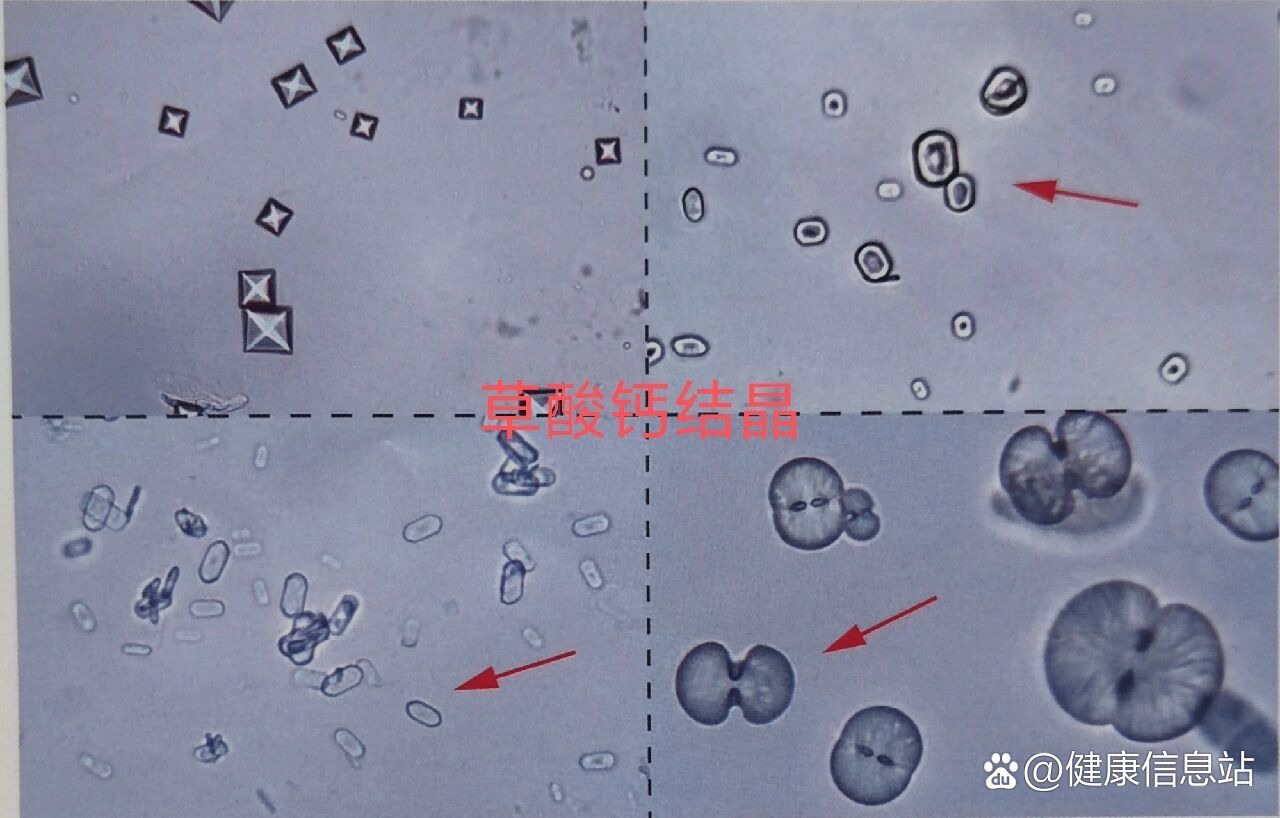 草酸钙簇晶显微图片图片