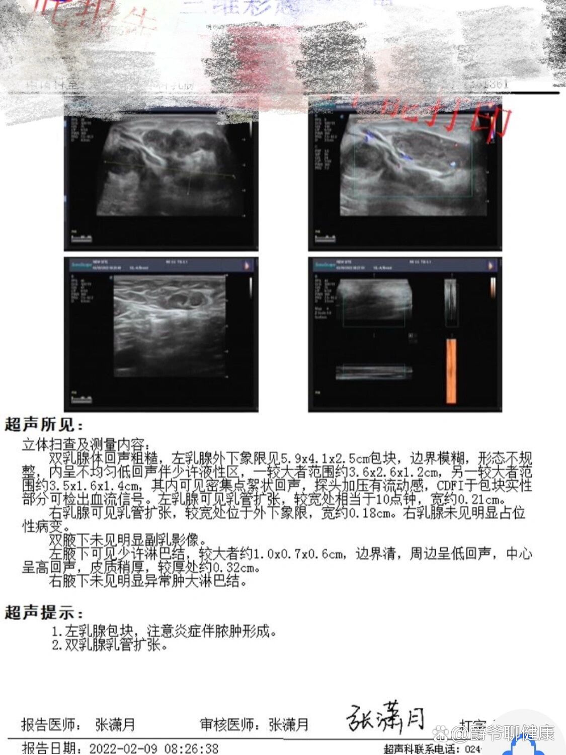 长春医大二院眼科挂号(长春医大二院眼科网上挂号)